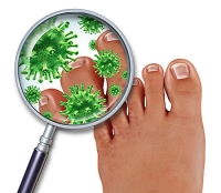 Where Does the Fungus That Causes Athlete’s Foot Live?