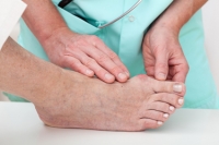 Is Bunion Surgery Right for You?