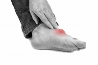 How Gout Can Affect the Feet