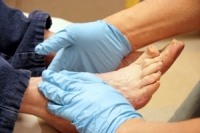 Foot Issues Caused by Diabetes